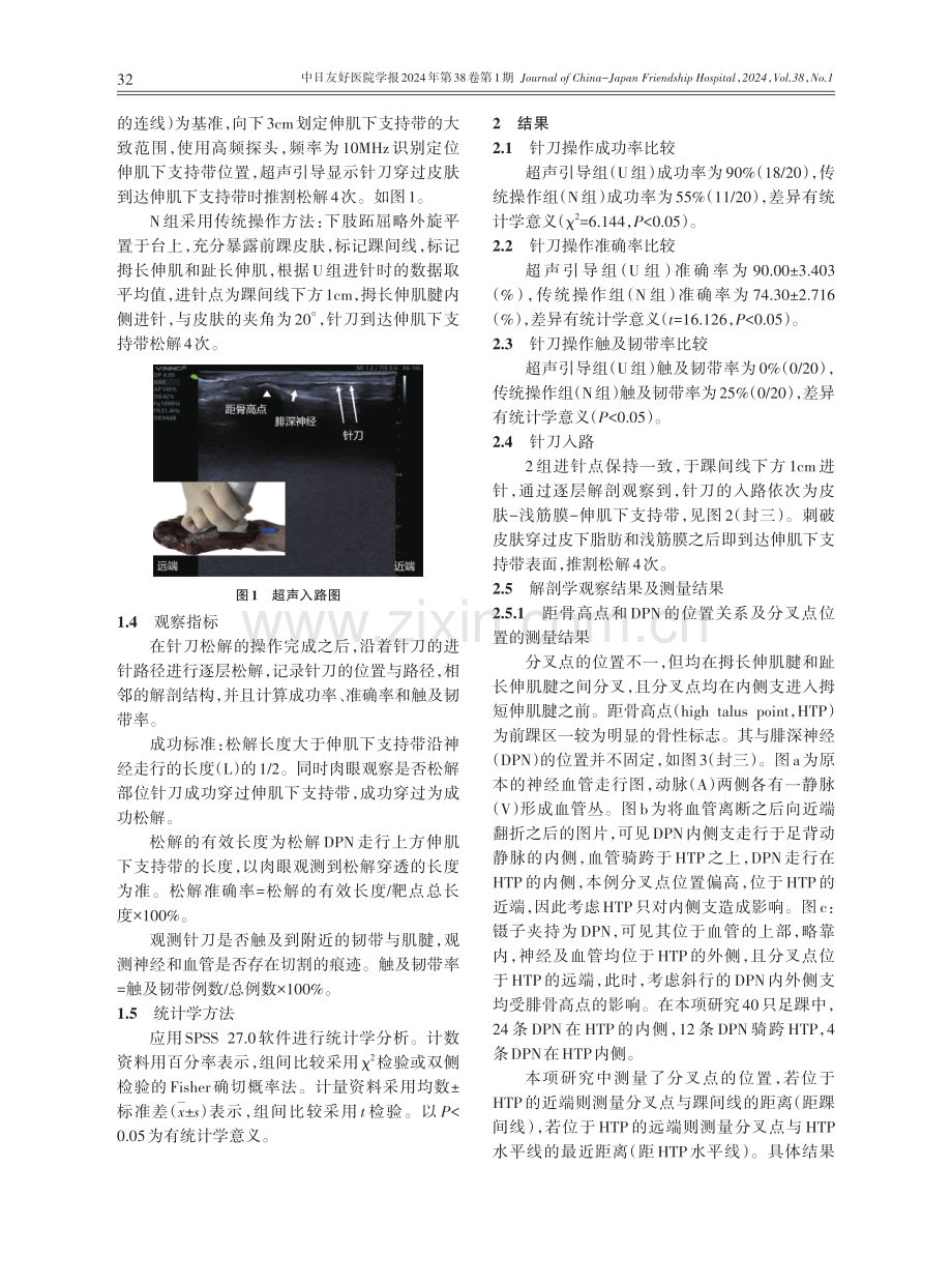 超声引导针刀松解术在前踝管综合征的临床解剖学应用.pdf_第2页