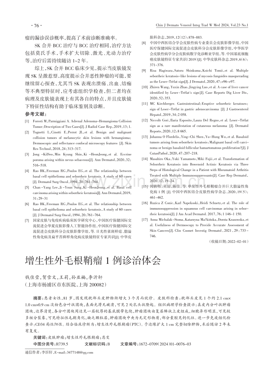 基底细胞癌伴发脂溢性角化皮肤镜表现1例.pdf_第3页