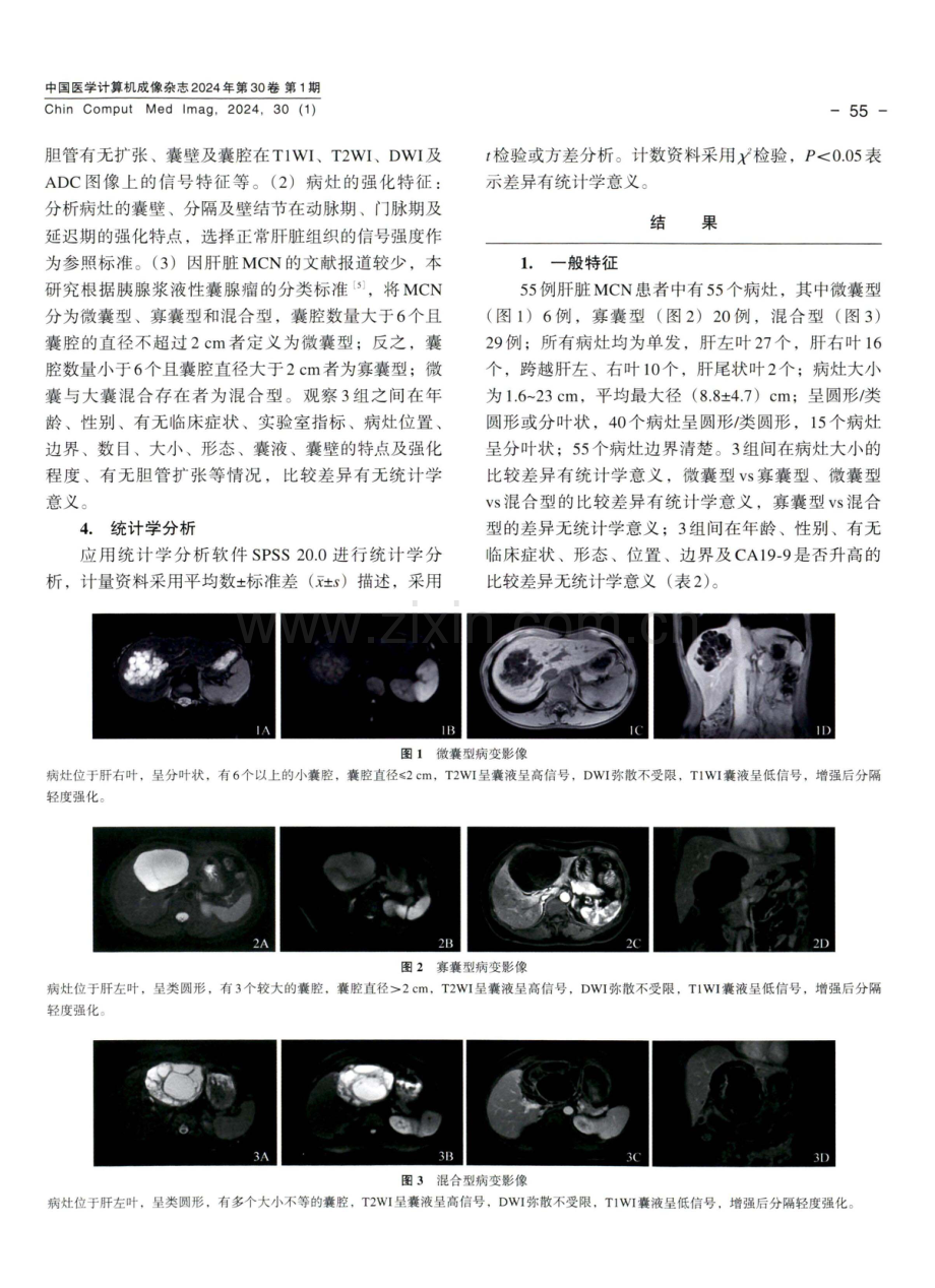 肝脏黏液性囊性肿瘤的MRI特征及分型.pdf_第3页