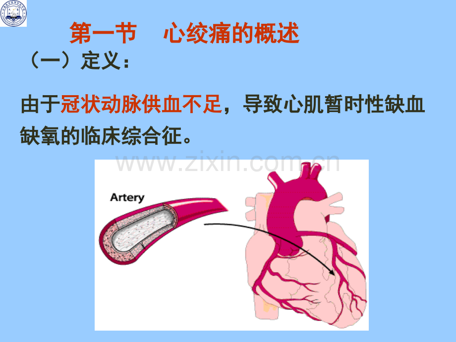 抗心绞痛课件医学PPT课件.ppt_第2页