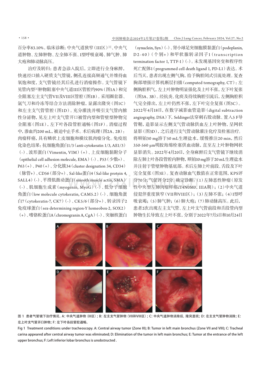 多域整合治疗复杂原发性肺肉瘤样癌1例.pdf_第2页