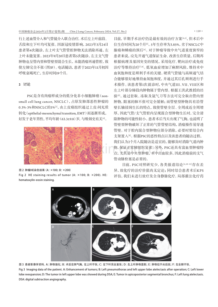 多域整合治疗复杂原发性肺肉瘤样癌1例.pdf_第3页