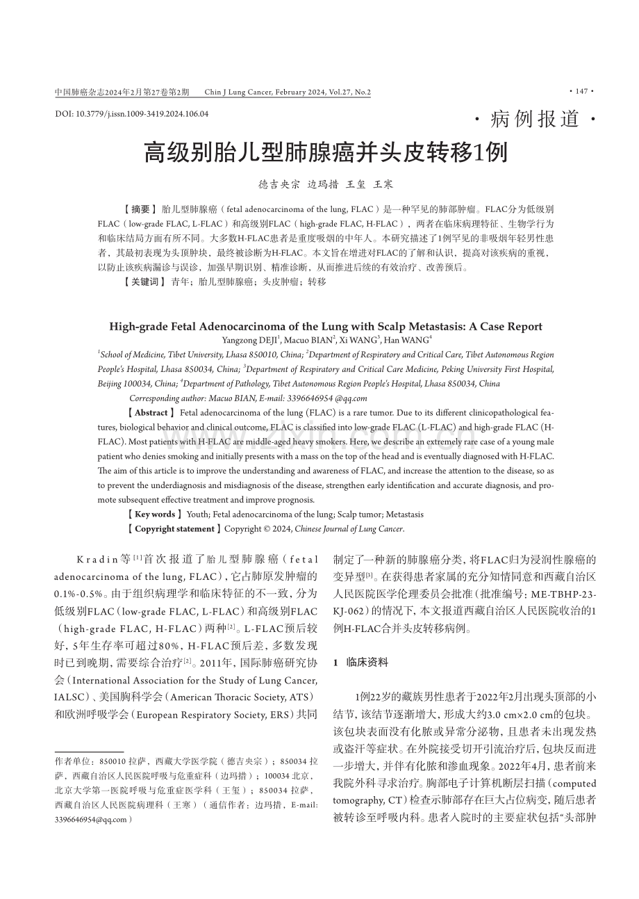 高级别胎儿型肺腺癌并头皮转移1例.pdf_第1页