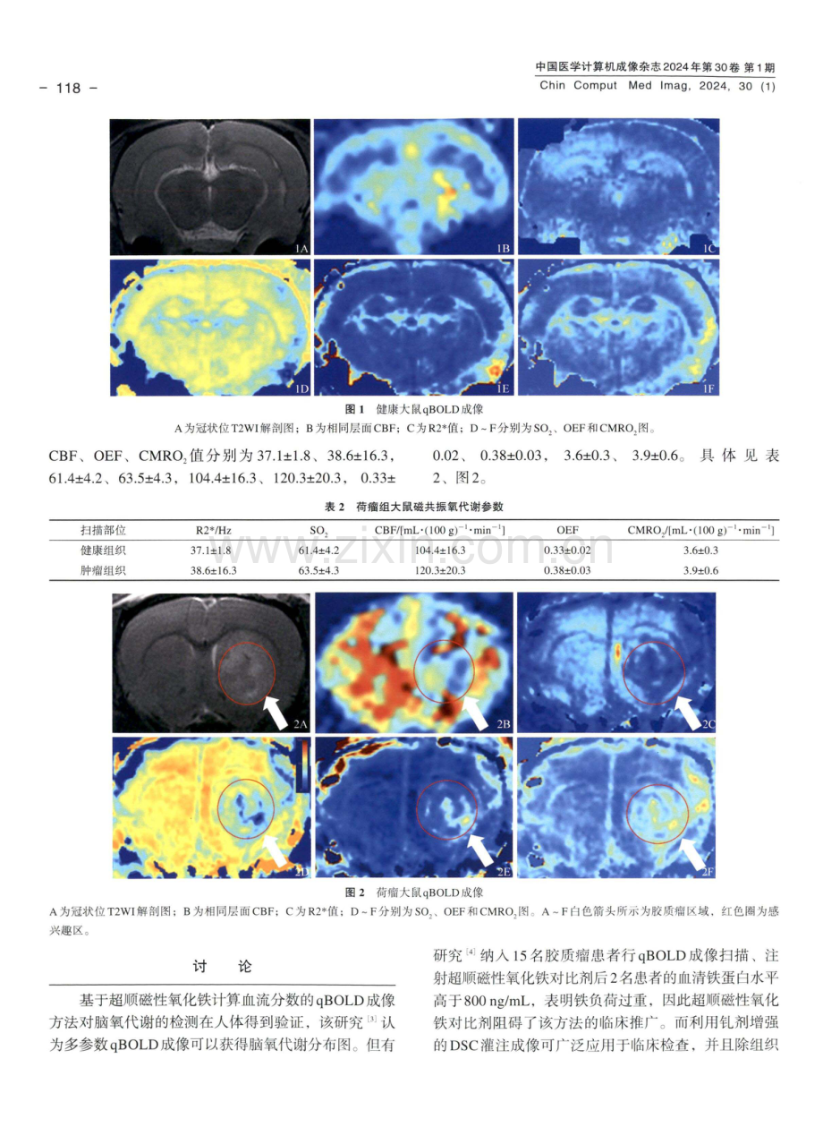 磁共振定量血氧水平依赖成像对大鼠脑氧代谢评估的可行性研究.pdf_第3页
