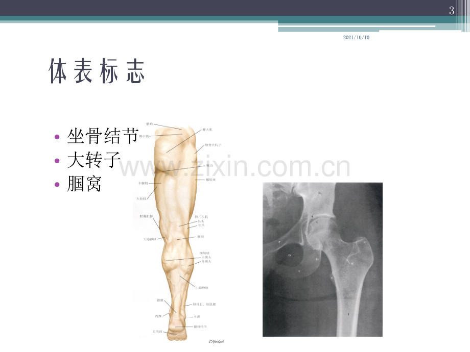 医用局部解剖学-臀部-股后区-腘窝-小腿后区及足底.ppt_第3页