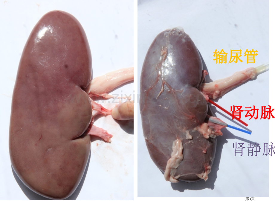 四单元生物圈中人人体内废物排出时市公开课一等奖百校联赛特等奖课件.pptx_第3页