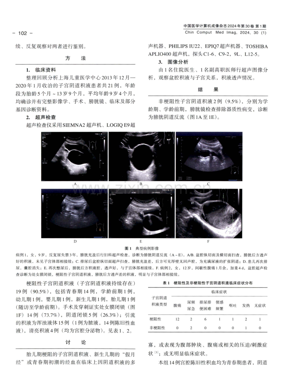 女童子宫阴道积液超声鉴别诊断及临床表现.pdf_第2页