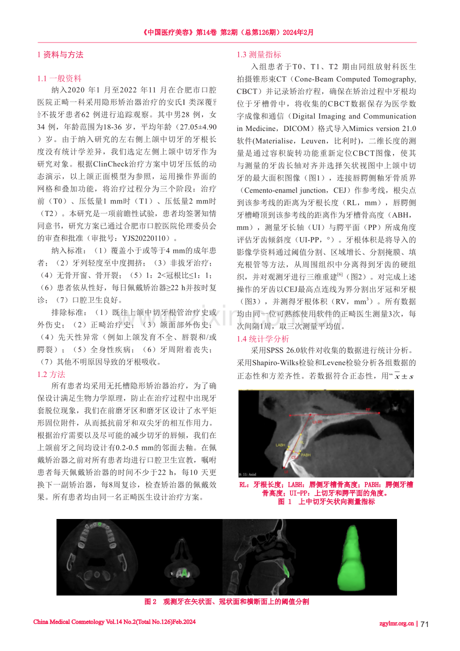 隐形矫治器设计上切牙压低量对牙根吸收的影响分析.pdf_第2页