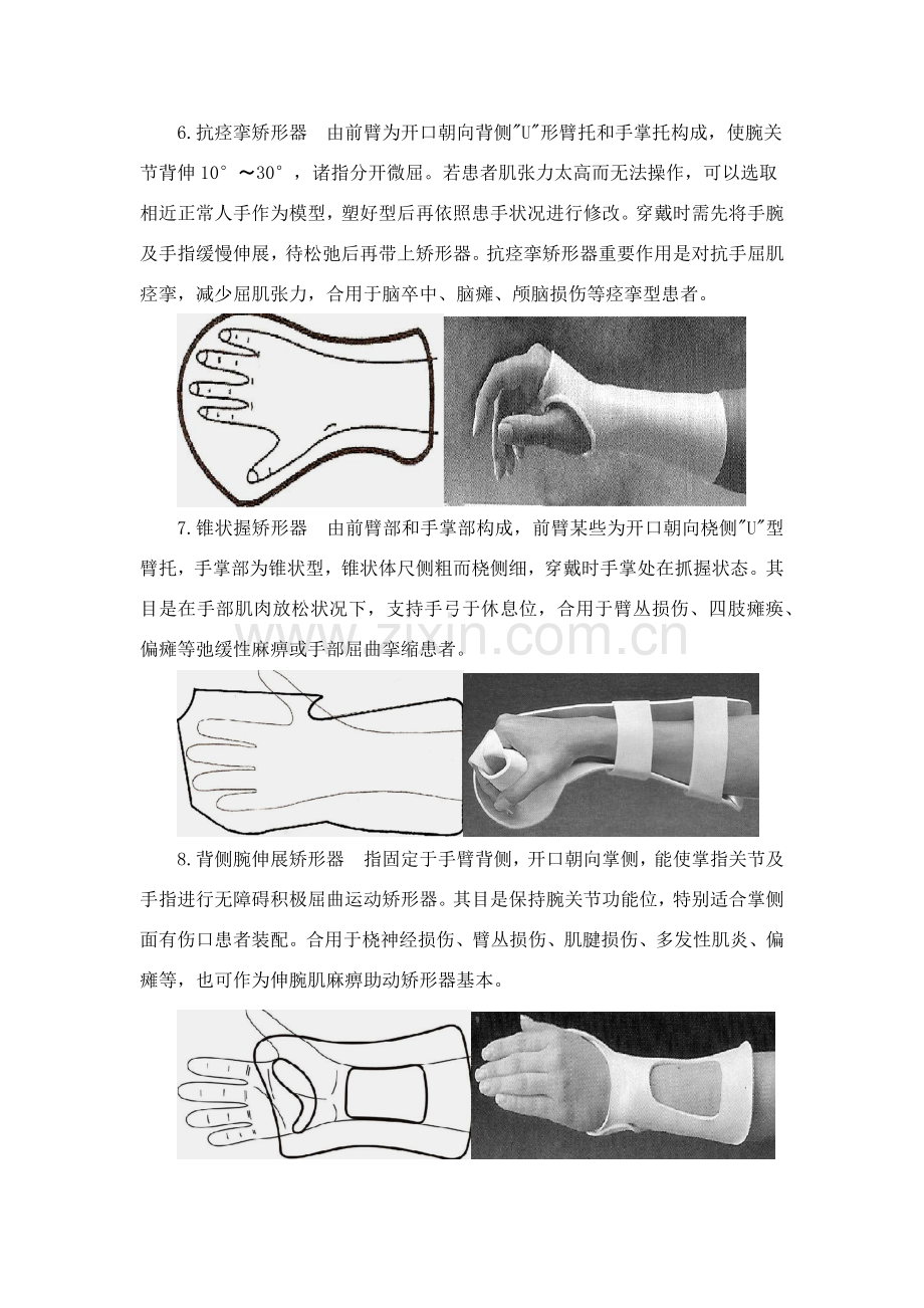 综合项目九矫形器常用低温热塑矫形器.doc_第3页