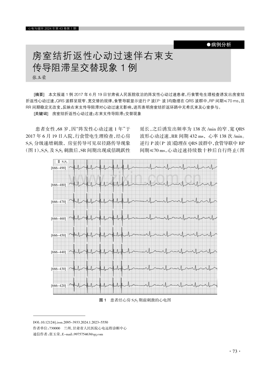 房室结折返性心动过速伴右束支传导阻滞呈交替现象1例.pdf_第1页