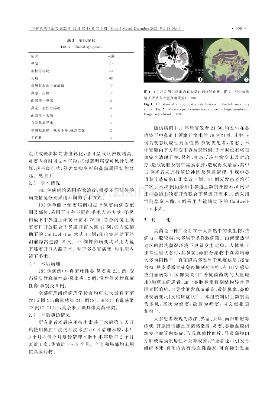 285例真菌性鼻-鼻窦炎的临床及病原菌分析.pdf_第3页