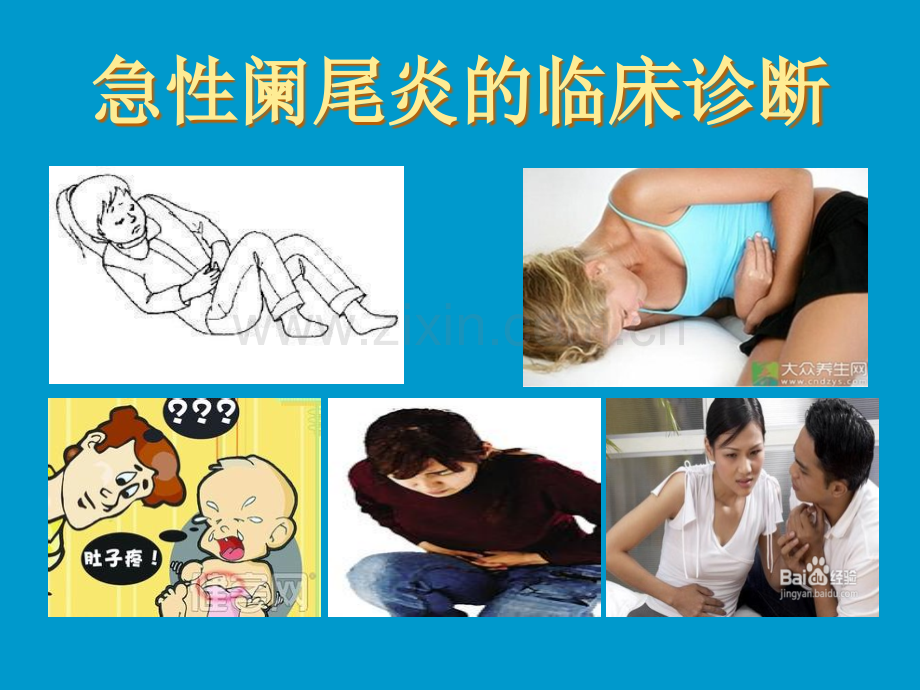 阑尾炎临床诊断医学PPT课件.ppt_第3页