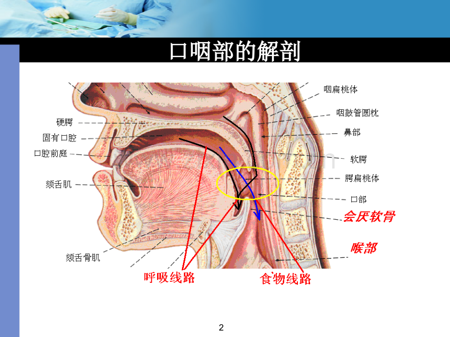 口咽通气道的使用.ppt_第2页