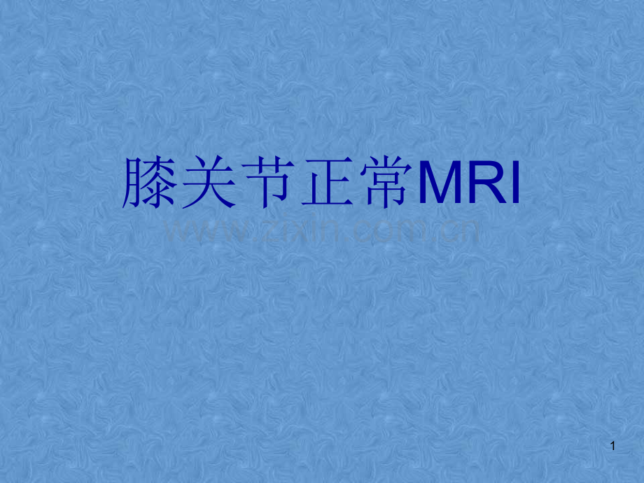 膝关节高清MRI解剖.ppt_第1页