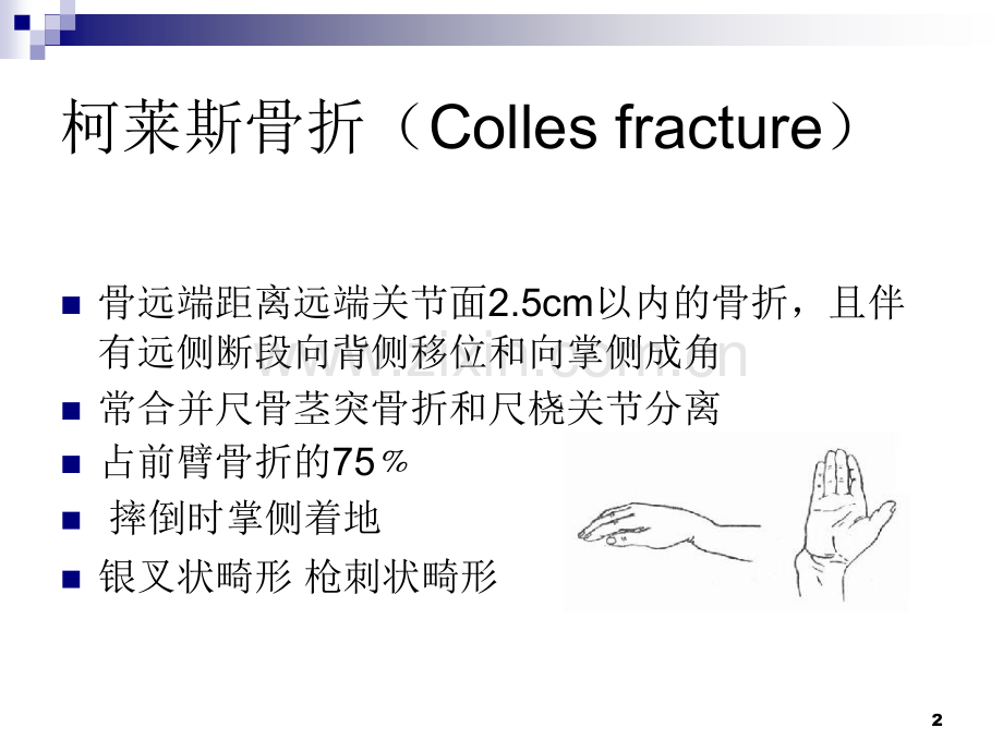 上肢骨折常见类型.ppt_第2页