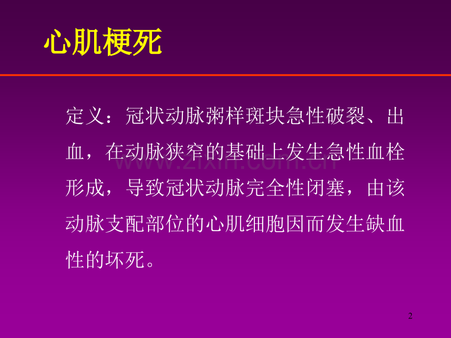 急性心肌梗死的治疗原则.ppt_第2页