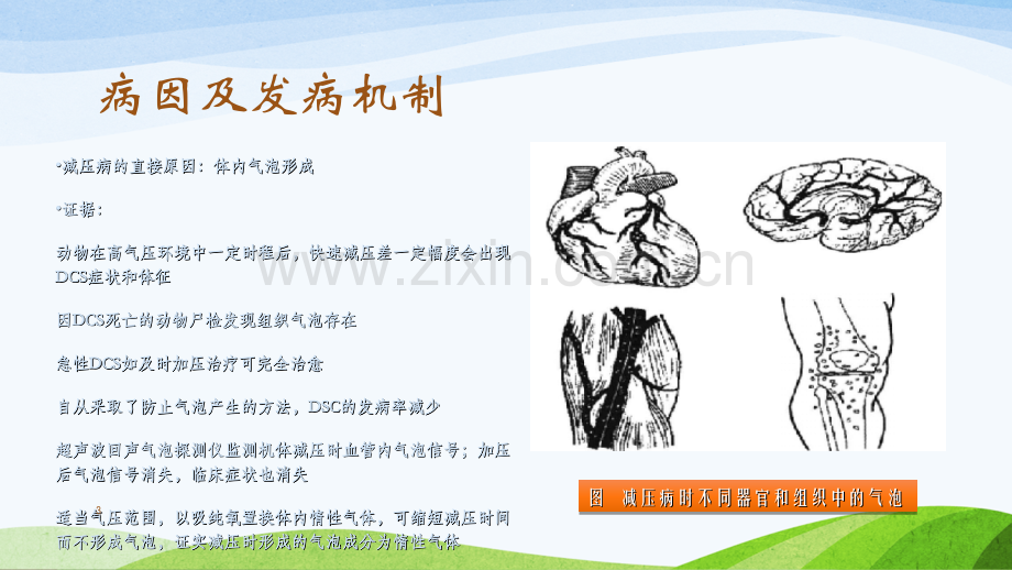 潜水减压病.ppt_第3页