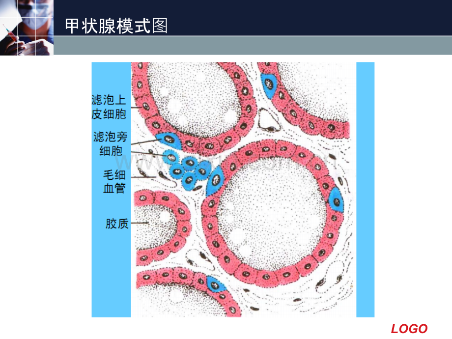 甲状腺常见疾病的CT表现.ppt_第3页