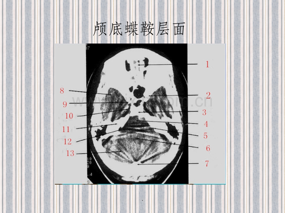 CT断层解剖.ppt_第3页