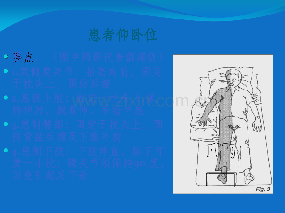 偏瘫患者良肢位摆放.ppt_第2页