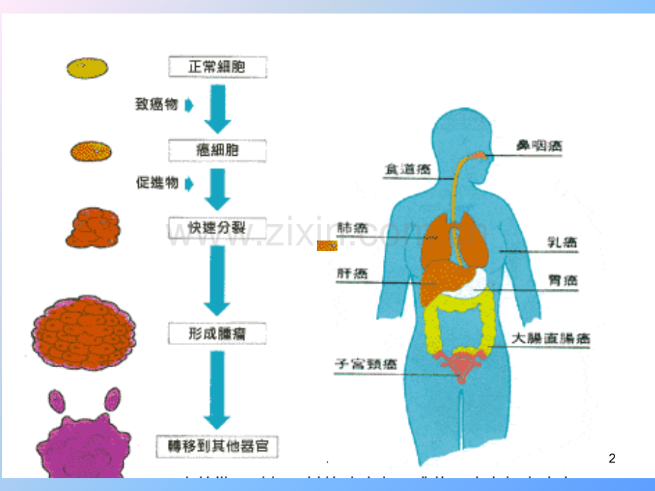 肿瘤基础知识.ppt_第2页