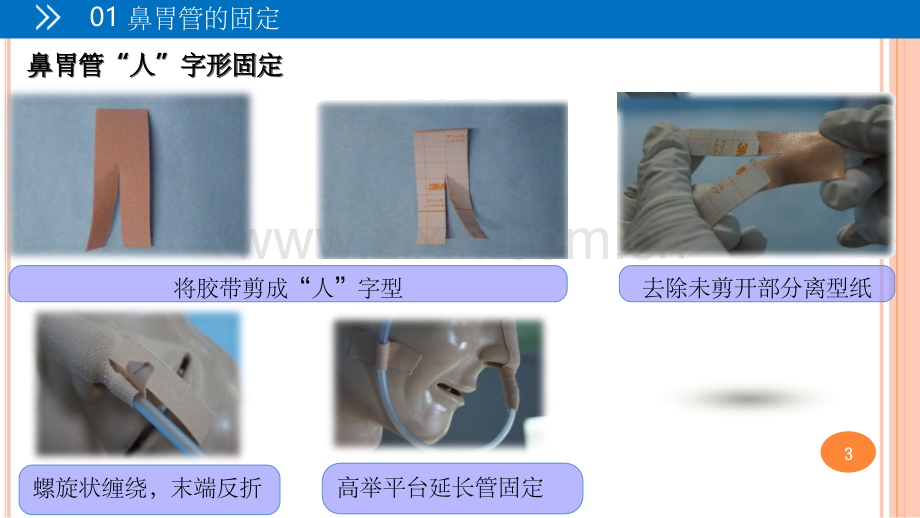 各种常见留置管道的固定方法.ppt_第3页