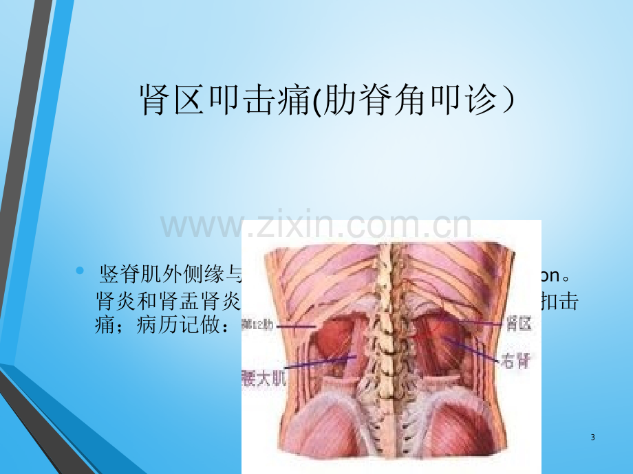 肾及输尿管压痛点.ppt_第3页