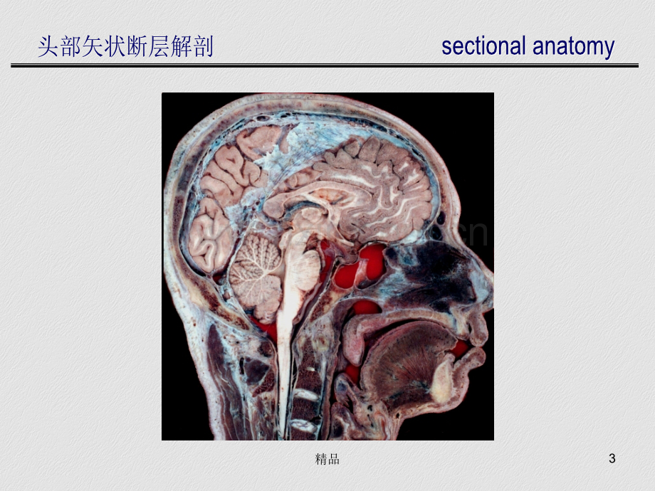 头部矢状断层解剖.ppt_第3页