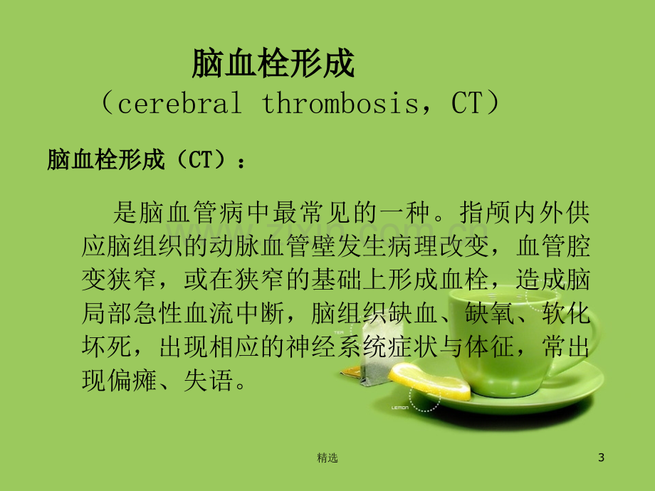 脑梗塞康复护理196744.ppt_第3页