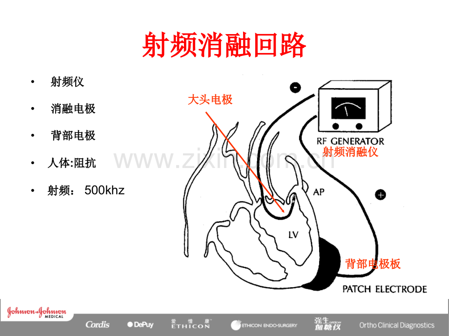 射频消融原理.ppt_第3页