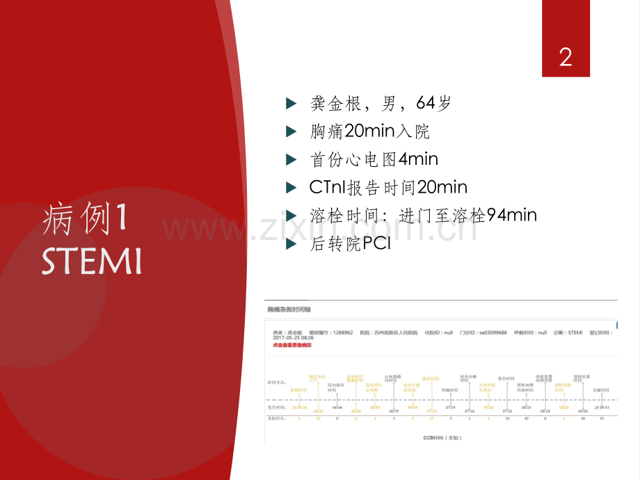 胸痛中心质量分析6.ppt_第2页