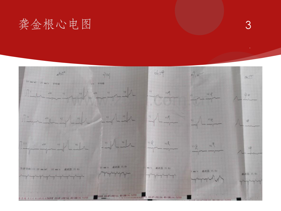 胸痛中心质量分析6.ppt_第3页