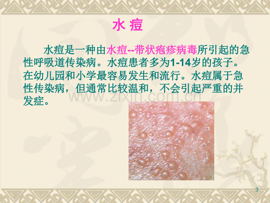 学生水痘流腮腹泻预防知识.ppt_第3页