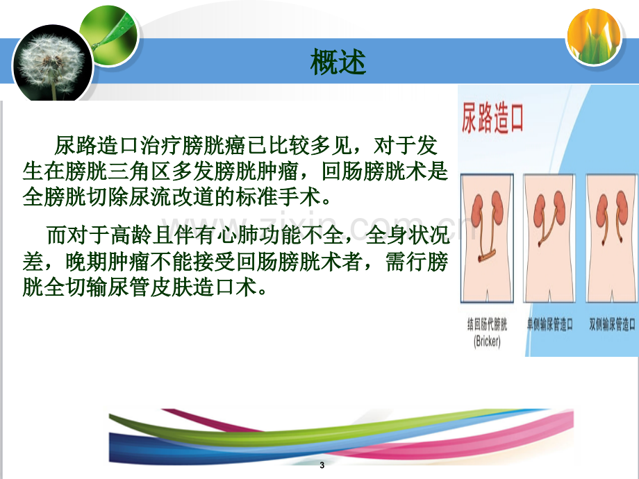 尿路造口周围并发症.ppt_第3页