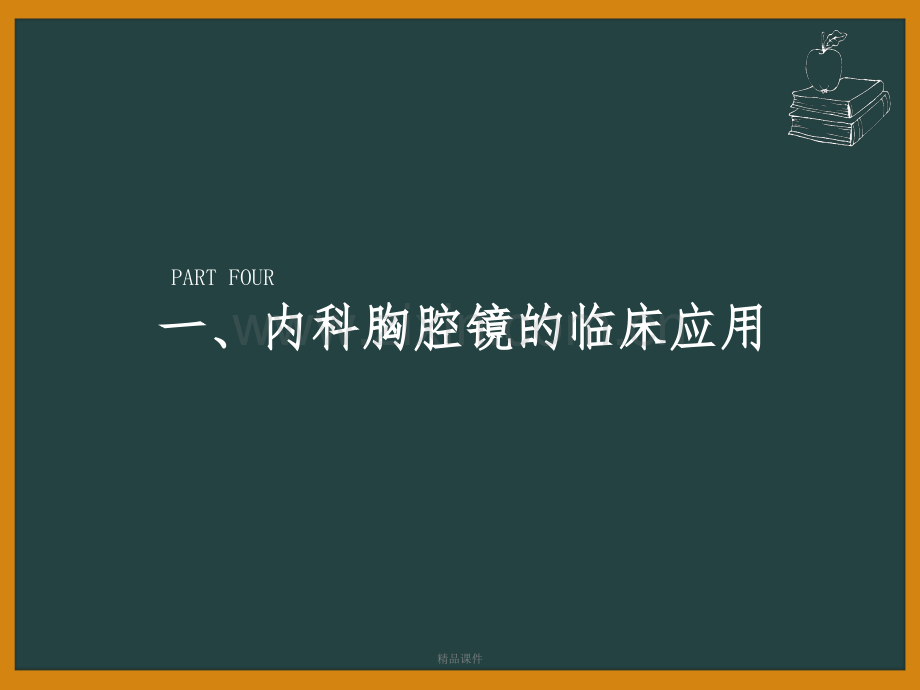 内科胸腔镜对胸腔积液的诊断价值.ppt_第3页