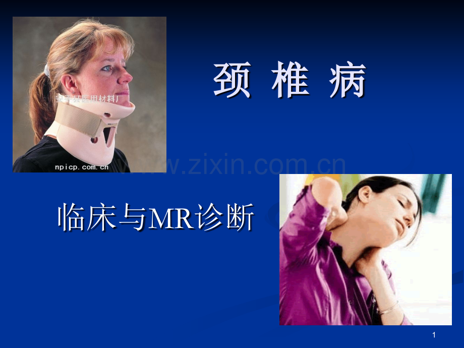 颈椎病的MRI诊断7.ppt_第1页