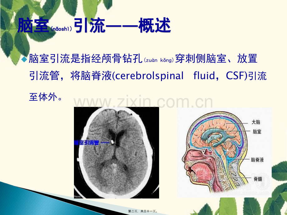 脑室引流及ICP监测系统.pptx_第2页