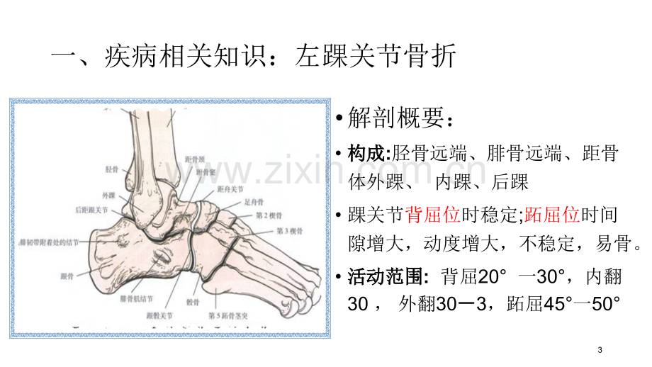 左踝关节骨折个案护理查房.ppt_第3页