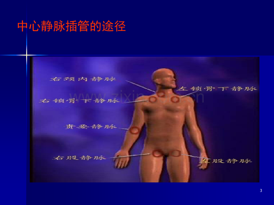 深静脉置管术.ppt_第3页