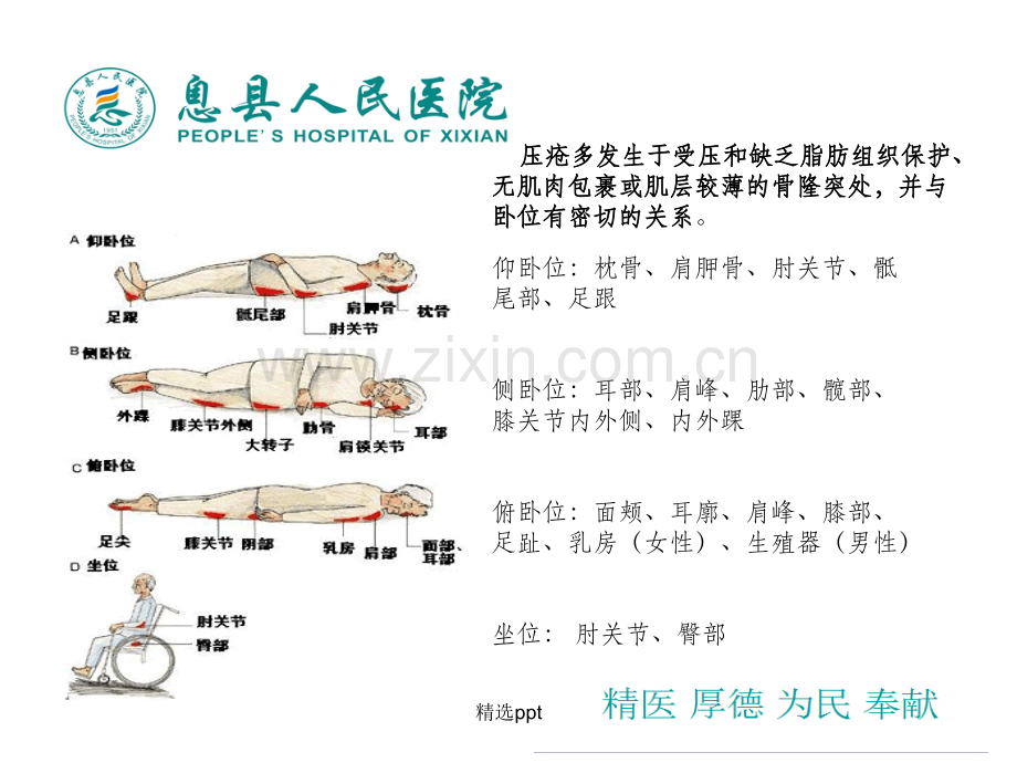 压疮的诊断和护理.ppt_第3页