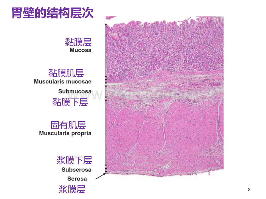 早期胃癌学习笔记.ppt_第2页