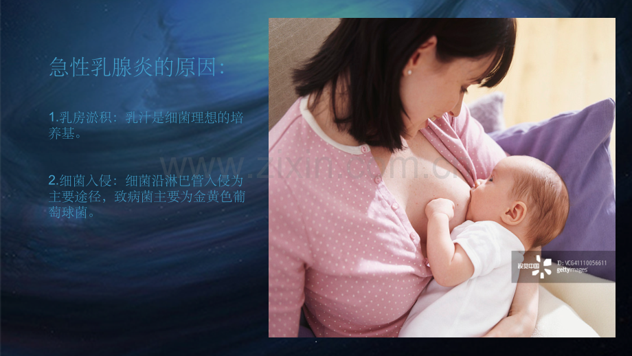 急性乳腺炎1.ppt_第3页