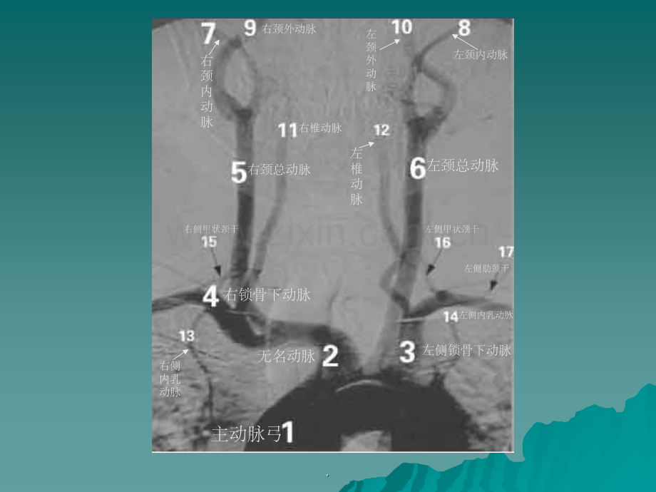 正常主动脉弓及其分支.ppt_第2页