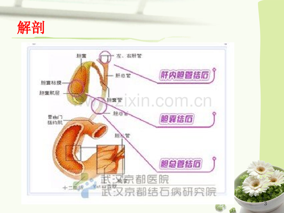 肝外胆管结石护理.ppt_第3页