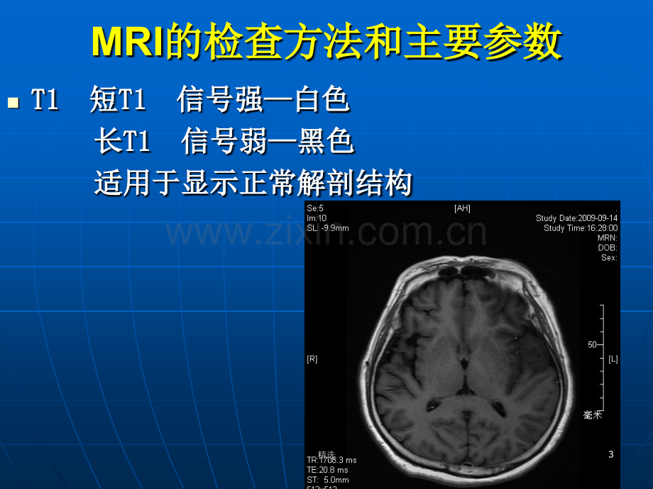 脑部磁共振呈像.ppt_第3页