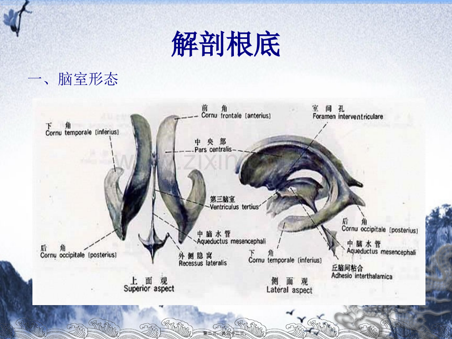 侧脑室穿刺术.pptx_第1页