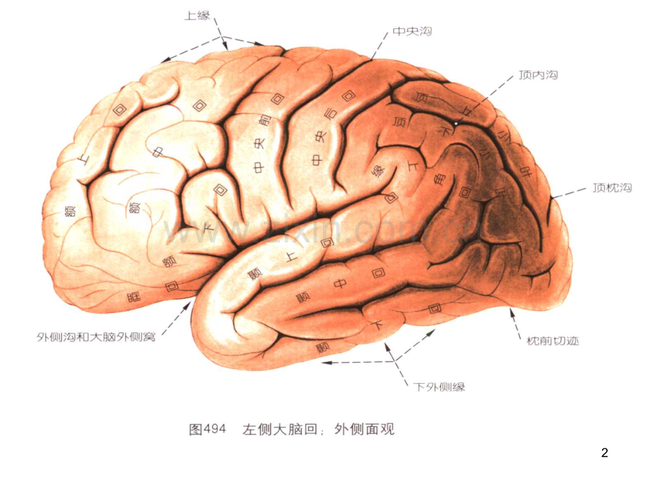 脑出血磁共振.ppt_第2页