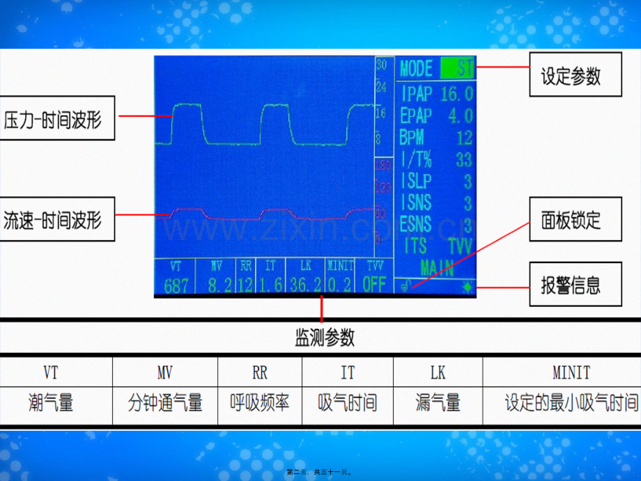 FLEXO无创呼吸机参数调节.ppt_第1页