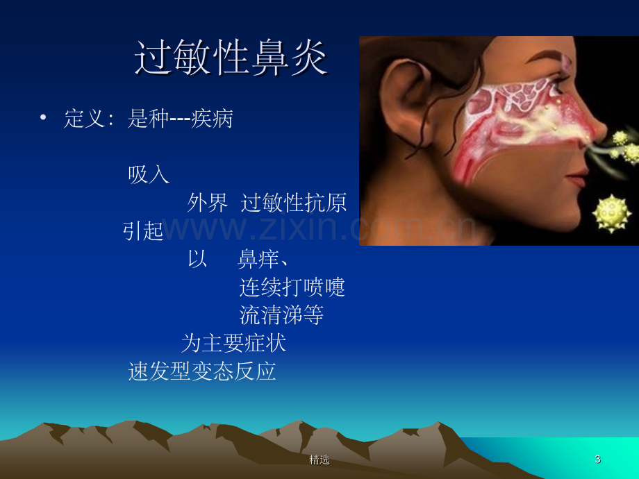 过敏性鼻炎.ppt_第3页