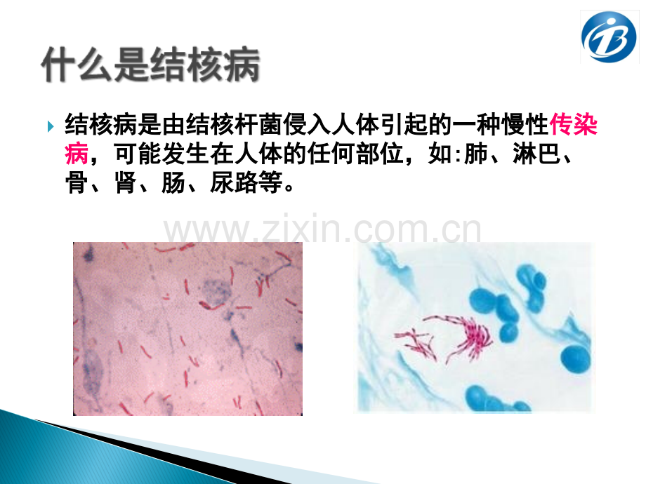 学校结核病防控知识学生篇.ppt_第3页